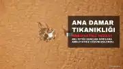 Bel Fıtığı Sanılan Ağrıların Nedeni Ana Damar Tıkanıklığı Çıktı: 73 Yaşındaki Hastaya Ameliyatsız Tedavi