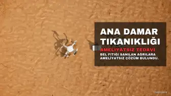 Bel Fıtığı Sanılan Ağrıların Nedeni Ana Damar Tıkanıklığı Çıktı: 73 Yaşındaki Hastaya Ameliyatsız Tedavi