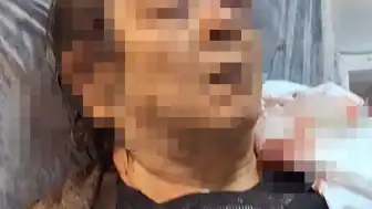Kayseri'de Tavandan Kopan Molozların Altında Kalan Vatandaş Yaralandı