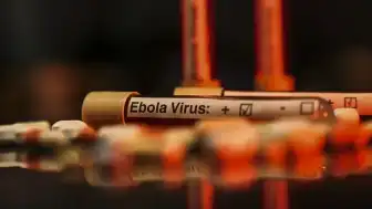 Fransa Sağlık Bakanlığı: Fransa topraklarında ilk Ebola vakası tespit edildi