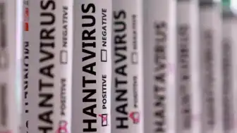 MV Hondius Gemisinde Hantavirüs Alarmı: Kayıp Numuneler 3 Can Aldı