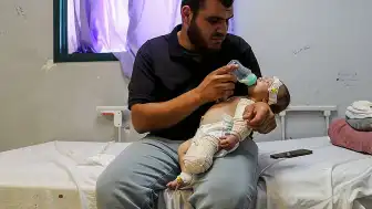 İsrail Saldırısında Annesini Kaybeden Bebek Muhammed'in Bacağı Ampute Edildi