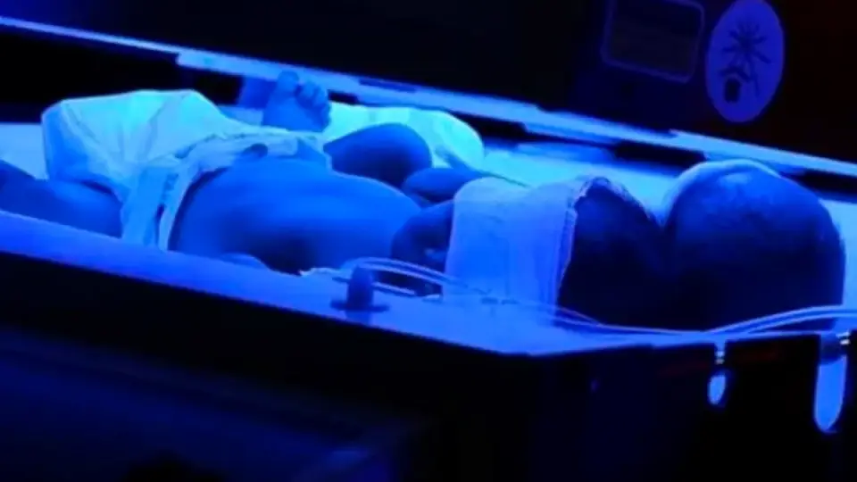 İstanbul'da Kuvözdeki Bebek Yanarak Ağır Yaralandı: Teknik İhmal İddiası