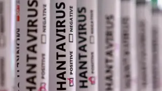 MV Hondius Gemisinde Hantavirüs Alarmı: Kayıp Numuneler 3 Can Aldı